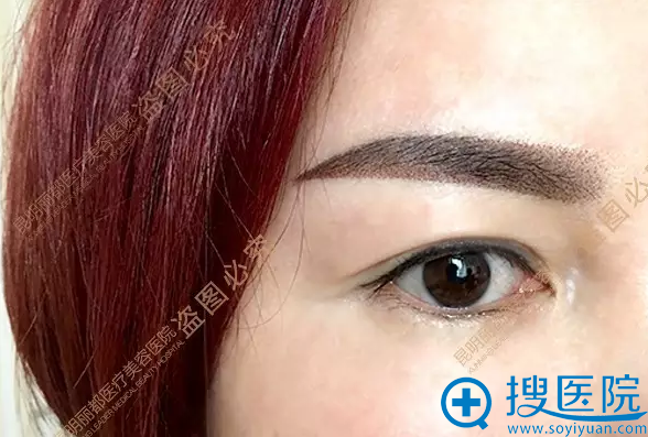 术后效果 术后效果