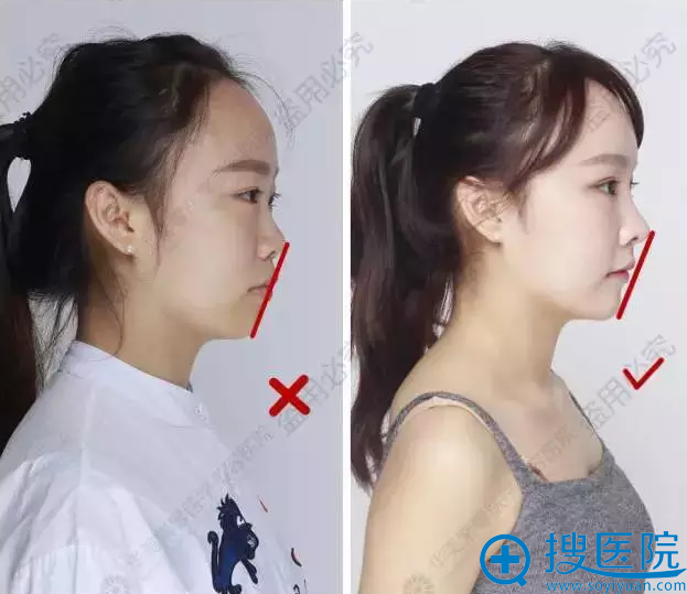 华美紫馨整形医生说脸漂不漂亮除了看眼睛鼻子 较重要的是牙齿