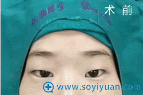 图上的姑娘是个什么样的情况 图上的姑娘是个什么样的情况