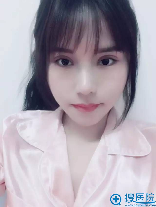 术后第十天效果 术后第十天效果