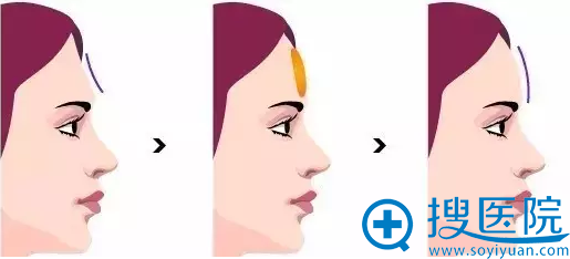 ע������ͷ����