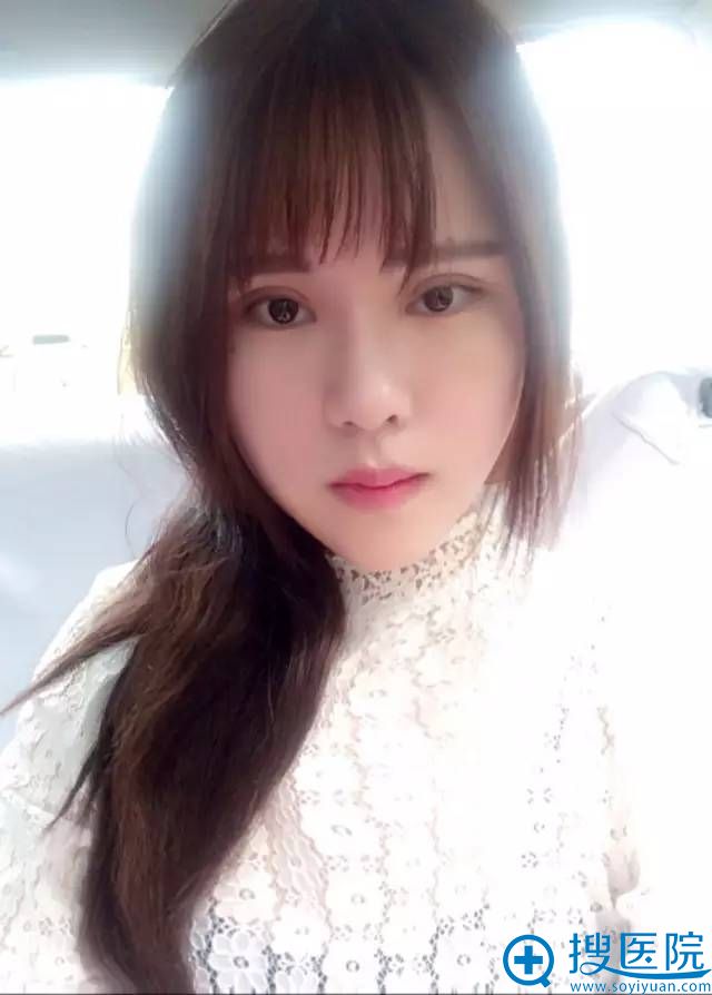 术后第20天效果 术后第20天效果