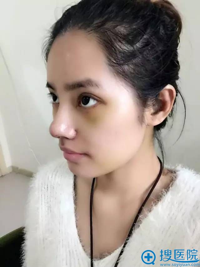 �����4��