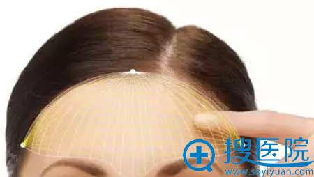  ����֬�����ͷ �ֲ���״ע�䱥����ƽ��