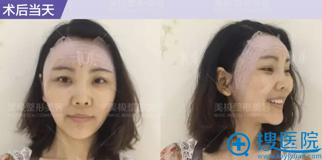 术后当天 术后当天