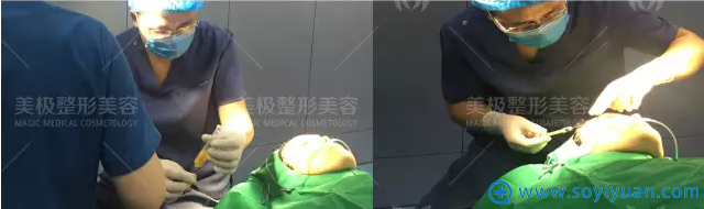 手术中 手术中