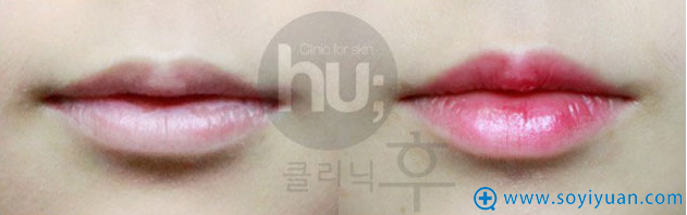 �뻪�а���֮�ƴ�