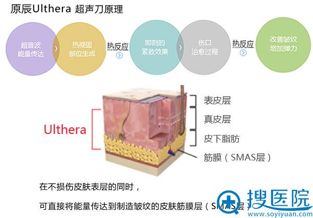 原辰Ulthera原理 原辰Ulthera原理