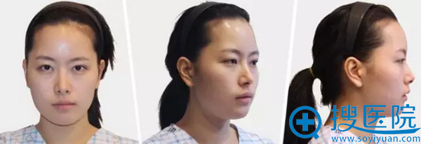 ����face-line�沿�������ΰ��� ģ�ز���������