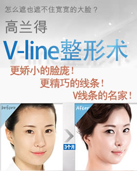 ��������������V-line�ķ��������� ������ӵ�й�������������