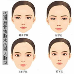 河南整形美容医院去颊脂垫真实案例对比图 成功摆脱婴儿肥脸