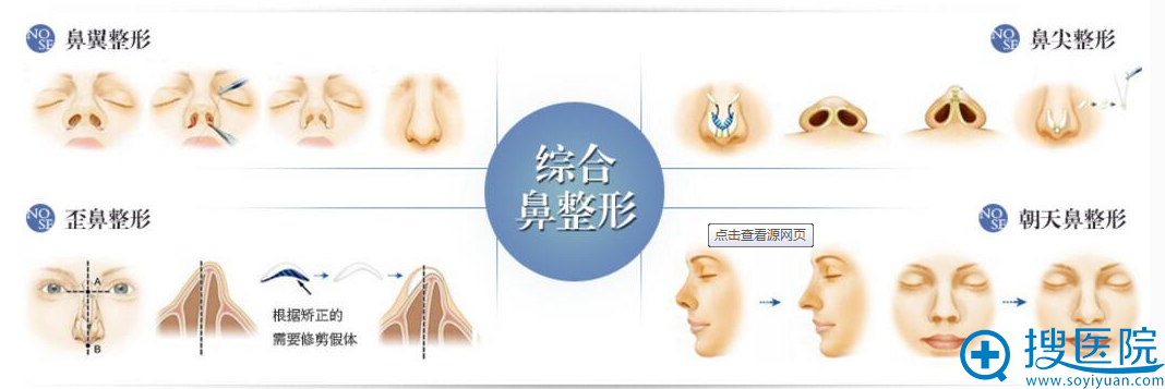 廊坊华康整形医生快速问答 关于综合隆鼻和隆鼻的差别