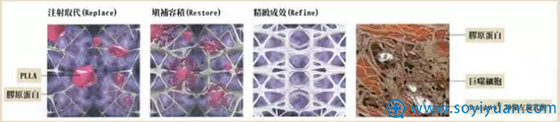 童颜针的主要成分 童颜针的主要成分