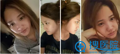�Ͼ���Ů�󷽹����ں���IDҽԺ¡��ȫ���� 