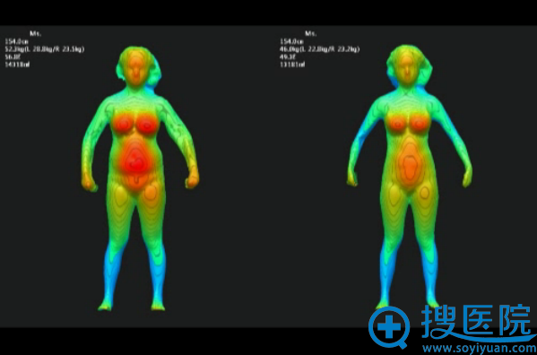 365mc医院通过3D体型测定机器进行多面并立体的诊断 365mc医院通过3D体型测定机器进行多面并立体的诊断