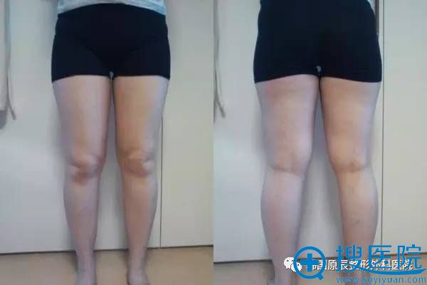 ��֬�᲻�ᷴ�� �������ں���ԭ����������֬�����ָ��ڵĹ���