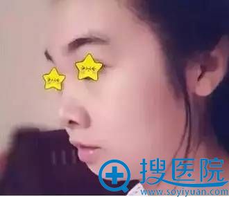 南京维多利亚整形告诉你 姑娘,你是嘴凸么 不,你是下巴短 南京维多利亚整形告诉你 姑娘,你是嘴凸么 不,你是下巴短