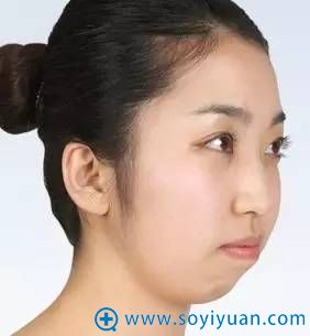 下巴短,就容易显得嘴巴外凸 下巴短,就容易显得嘴巴外凸