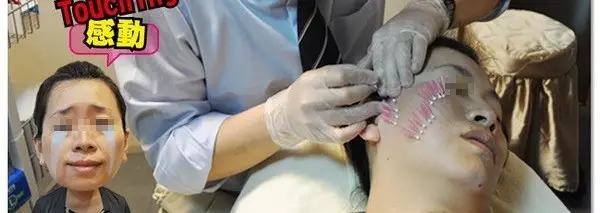 ����ʩ����ҽ�����ڽ����ߵ�����������ʾ