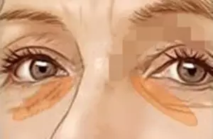 ����ʩ������������ҽԺ �ṵ��ʾͼ
