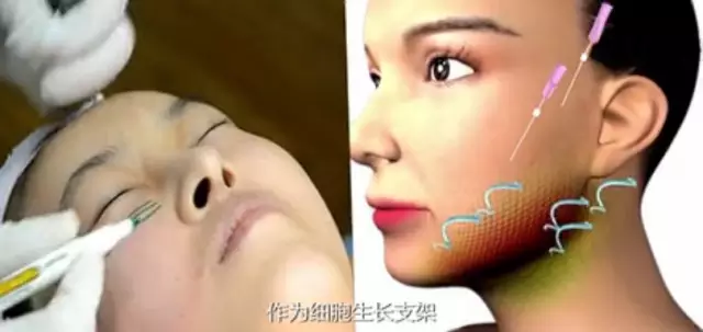 �ߵ����������壬������Ϊϸ������֧��
