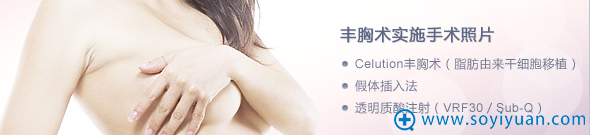 日本圣心整形医院假体丰胸+胸部修复整形价格表 手术案例展示