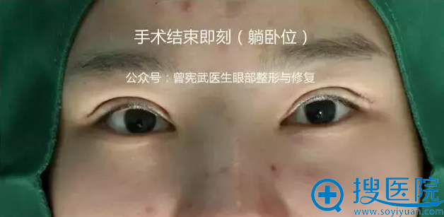手术结束即刻躺卧位效果 手术结束即刻躺卧位效果