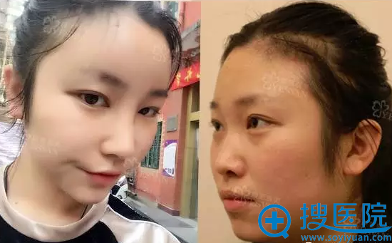 �Ϻ��շ�������+����֬����䰸�� ��ĥ��Ҳ��ӵ�о�������