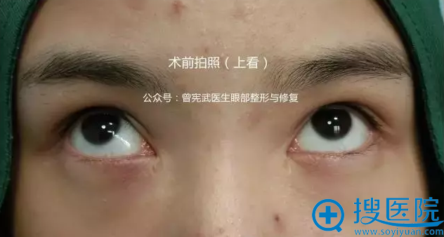 术前上看拍照情况 术前上看拍照情况