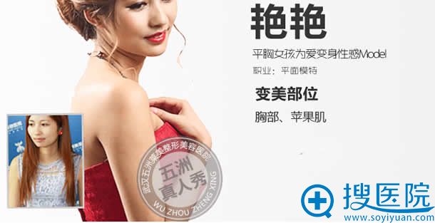 五洲整形胸部整形效果对比图 五洲整形胸部整形效果对比图