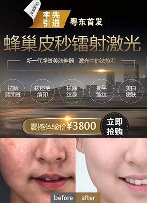 汕头曙光整形蜂巢皮秒镭射震撼来袭 体验价3800元告别斑点人生