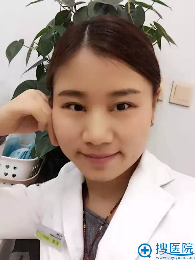 杭州时光双眼皮修复手术26天啦 杭州时光双眼皮修复手术26天啦