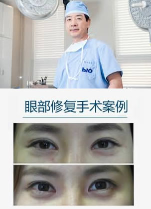 ����BIO���β��ʲ��۾��޸������Ա�ͼ �����������������鴫