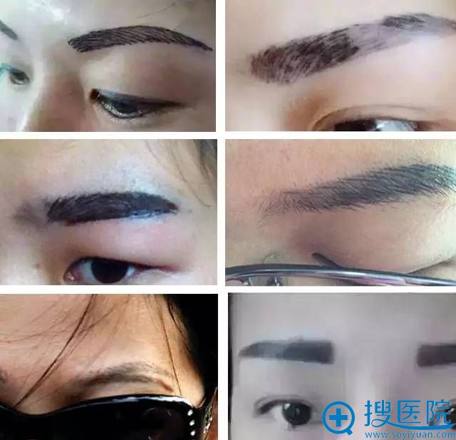 沈阳百嘉丽整形医院新年礼 10元洗眉100000名再不来名额就满了 沈阳百嘉丽整形医院新年礼 10元洗眉100000名再不来名额就满了