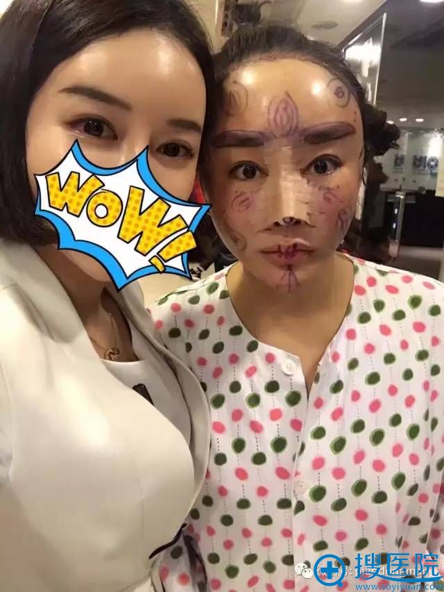 bio�Ӷ����沿�������廼����Ƶ����