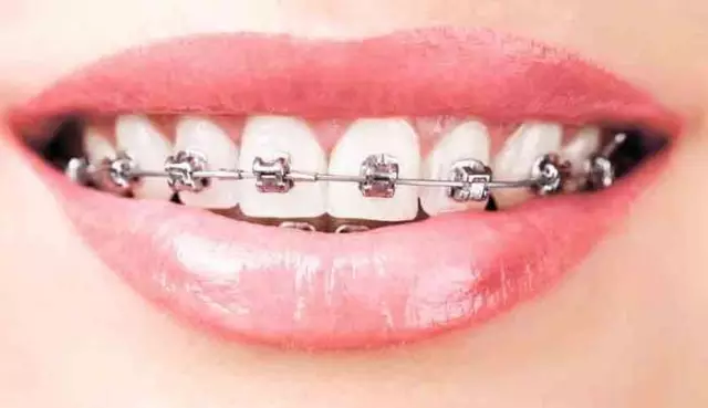 �Ϻ���������ҽԺ�������������׽����۸�39800Ԫ ��ѧ��֤9��
