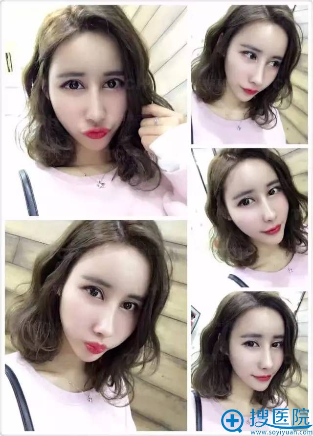�Ⱜ��˫��Ƥ+¡������30��ָ�Ч��