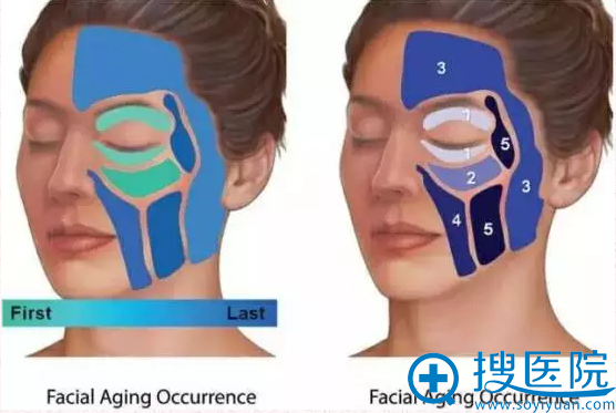 人体面部脂肪室的分部 人体面部脂肪室的分部