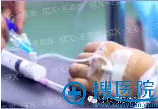 术前检查,血液检查、心电检查等 术前检查,血液检查、心电检查等