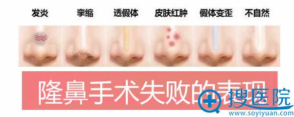 隆鼻手术失败的表现症状 隆鼻手术失败的表现症状
