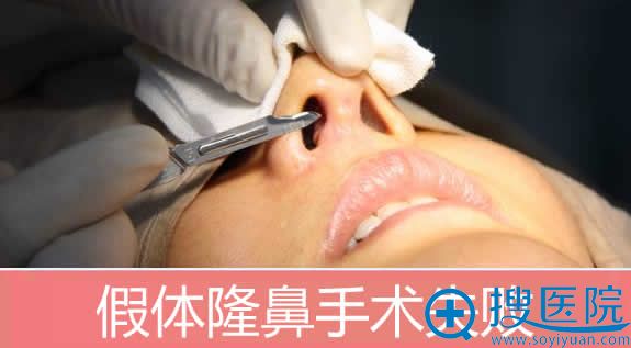 <!--<i data=20240710 data-id=16581></i>-->分析假体隆鼻失败如何修复 <!--<i data=20240710 data-id=16581></i>-->分析假体隆鼻失败如何修复