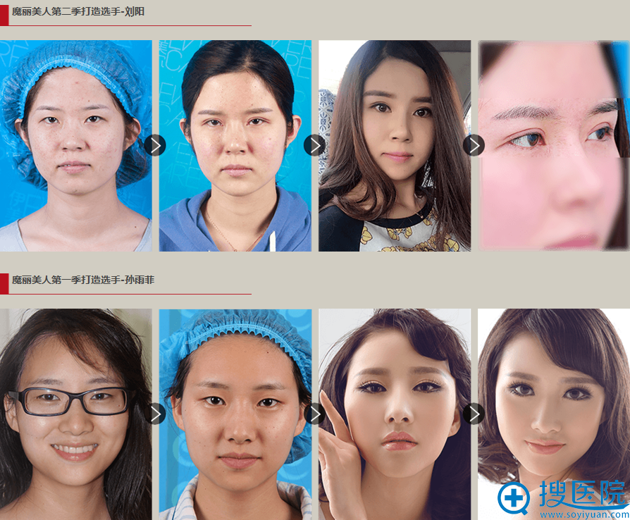 <!--<i data=20240710 data-id=12673></i>-->整形医院杨文国案例展示: <!--<i data=20240710 data-id=12673></i>-->整形医院杨文国案例展示: