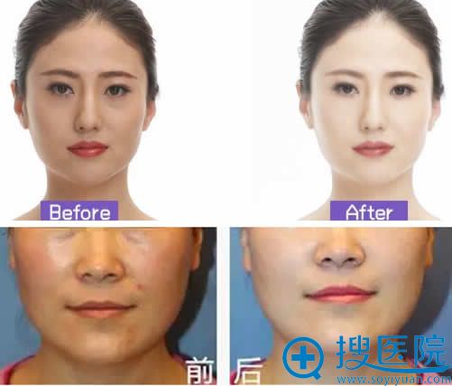 <!--<i data=20240710 data-id=14095></i>-->DEP案例效果图 <!--<i data=20240710 data-id=14095></i>-->DEP案例效果图