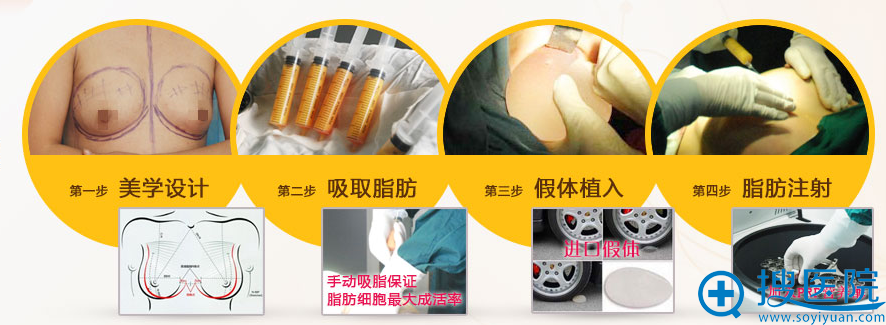 脂肪伞丰胸术流程 脂肪伞丰胸术流程