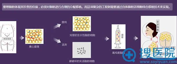 自体脂肪提纯过程 自体脂肪提纯过程
