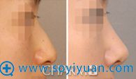 ���쵱������ҽԺ�������շ�ǽ���ǰ��ԱȰ���