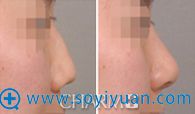 ���쵱������ҽԺ�������ۺ�¡��ǰ��ԱȰ���