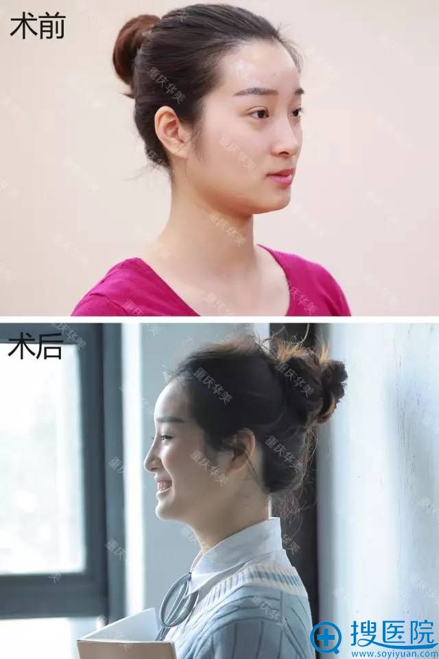 ���컪������ҽԺ����ǰ�����ٳɹ��Ըɻ����� �����Ͽ�get����