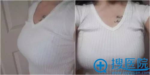 ����¡������һ����
