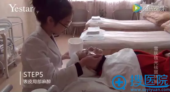艺星雪肤核光第五步表皮局部麻醉 艺星雪肤核光第五步表皮局部麻醉